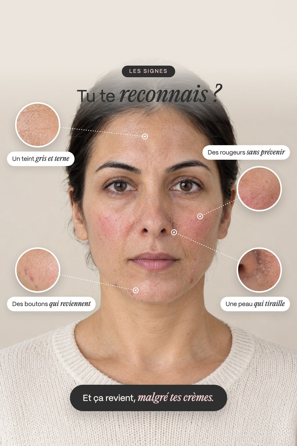 Tu te reconnais ? Boutons, teint terne, rougeurs, peau qui tiraille