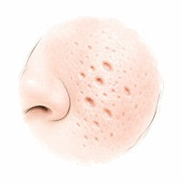 Pores dilatés : pourquoi ton intestin est la clé