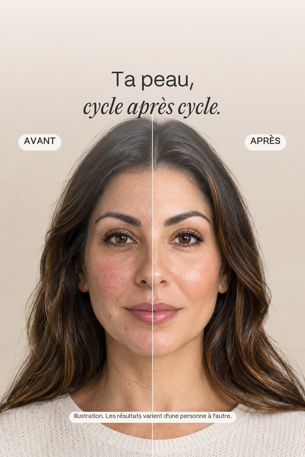 Avant et après, illustration