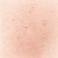 Peau sèche : le vrai problème vient-il de l'intérieur ?